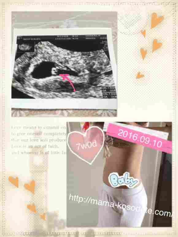 【妊娠初期】2ヶ月（7週）の体調、お腹、エコー写真