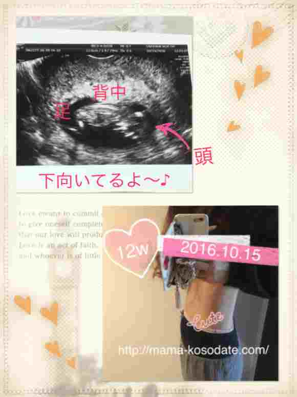 【妊娠初期】4ヶ月（12週）の体調、お腹、エコー写真